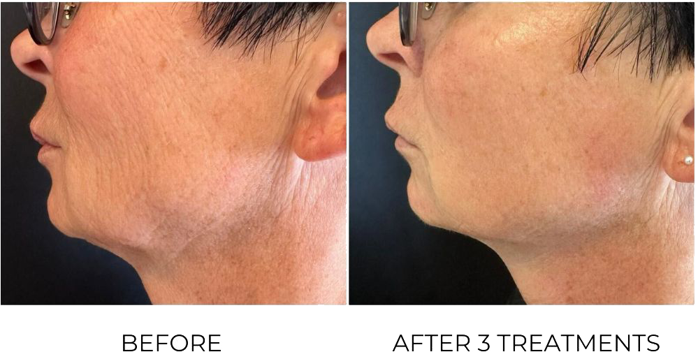 artemis-3-Treatments-face-ba